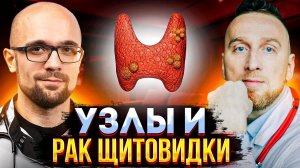 Рак щитовидной железы – что это? @Занимательная эндокринология @Доктор Утин 