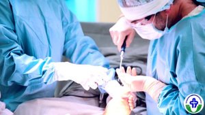 О вальгусной деформации стопы "Шишки на стопе"