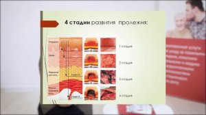 ПРОФИЛАКТИКА ПРОЛЕЖНЕЙ: ОСНОВЫ УХОДА