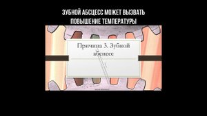 Зубной абсцесс может вызвать повышение температуры