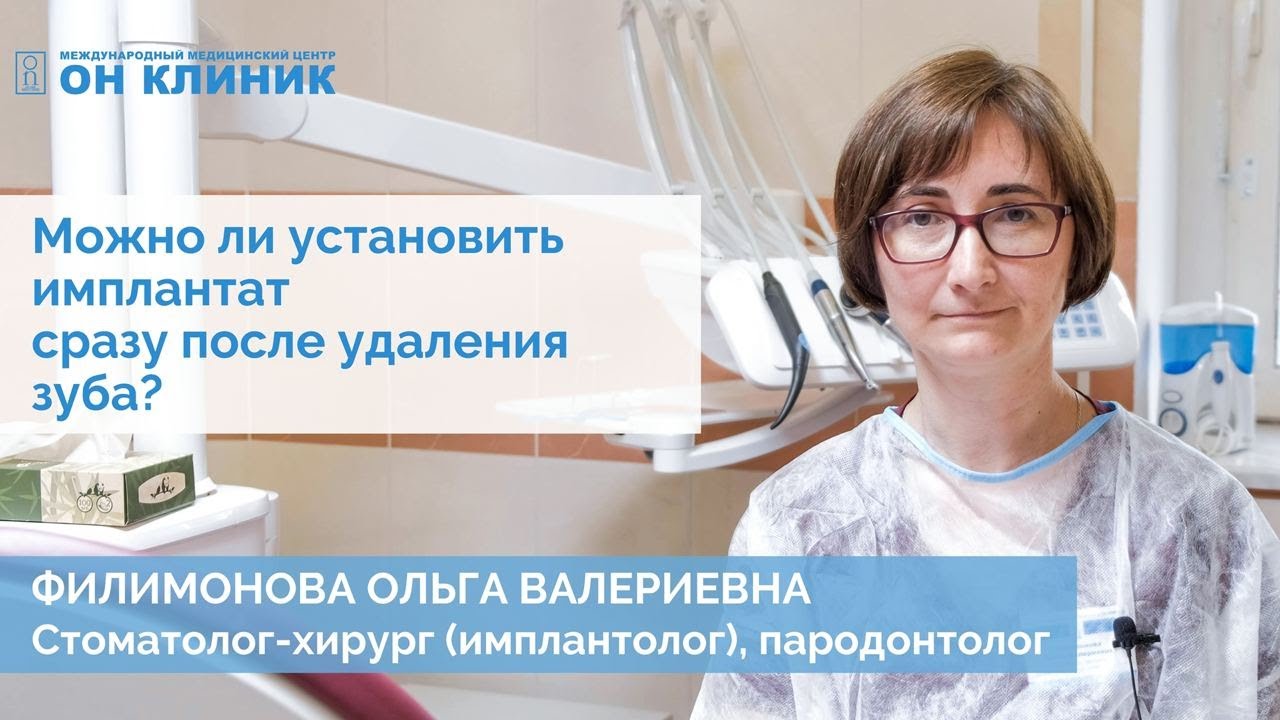 Можно ли установить имплантат сразу после удаления зуба?