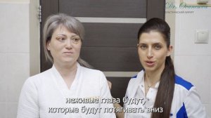 Блефаропластика✦Пластика Верхних и Нижних Век✦Разметка✦Пациент 72✦Ованесова Ольга