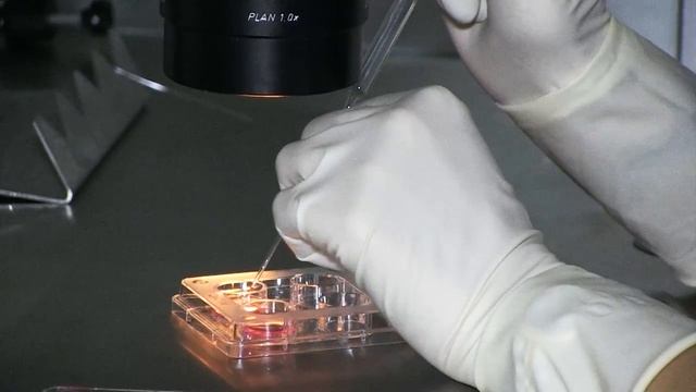 Причины эпилепсии и Как ее ПРАВИЛЬНО лечить смотреть онлайн