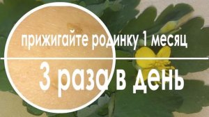Как удалить родинку в домашних условиях