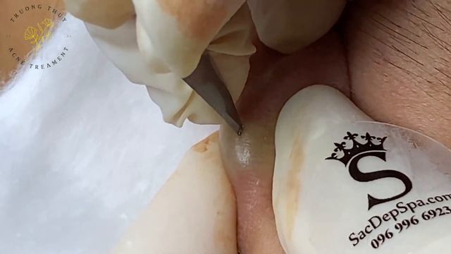 Satisfying Relaxing With Sac Dep Spa Video #576