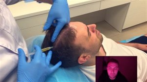 Плазмотерапия (PRP) для волос: Новое слово в борьбе с облысением!