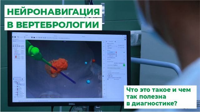 Нейронавигация в вертебрологии. Что это такое и чем так полезна в диагностике.