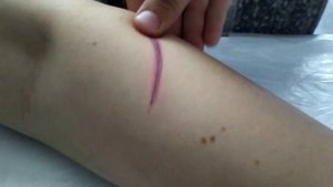 Как рисовать шрамы. Ч. 1