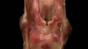 Анатомия человека. Гортань.