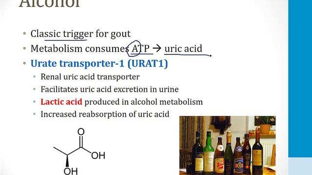 Опорно-двигательный аппарат USMLE - 3. Патология - 6.Подагра