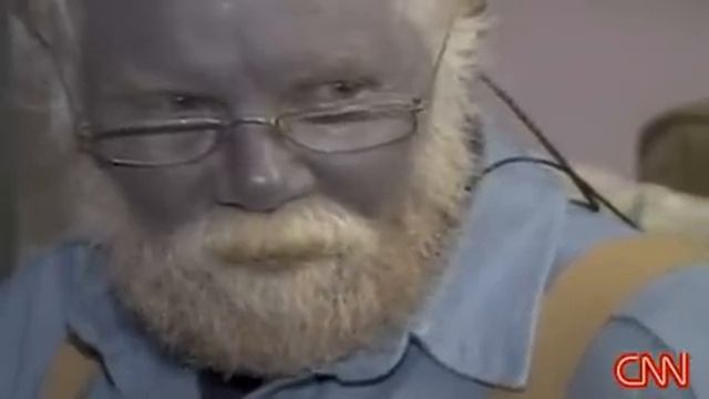 The Dangers of Colloidal Silver