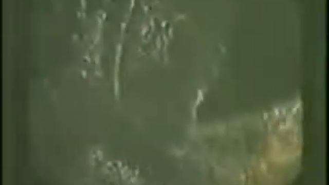 Гельминты   Шокирующее Видео   Паразиты внутри нас!