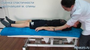 Оценка спастичности широчайшей м. спины по модифицированной шкале Эшворта