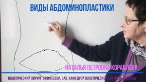 Виды абдоминопластики