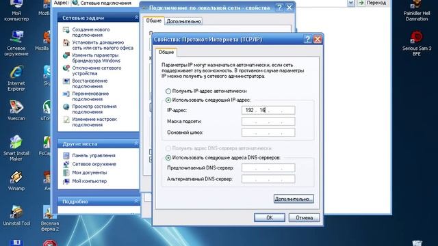 Как прописать Ip на сетевой карте Xp смотреть онлайн
