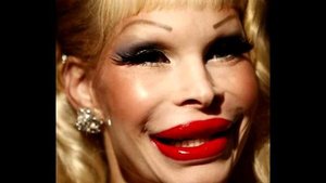 Жертвы пластической хирургии и ботокса .