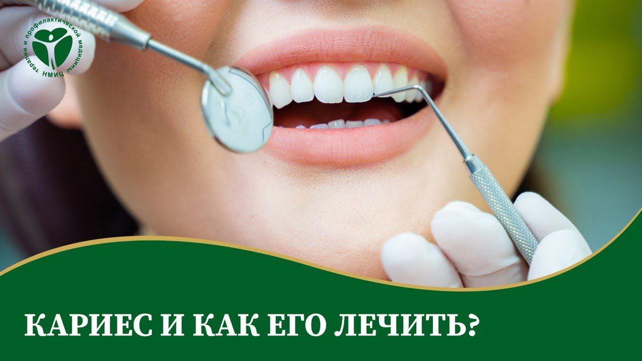 Кариес и как его лечить