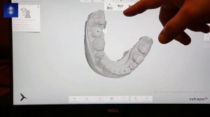 Внутриротовой сканер  3SHAPE TRIOS 3Pod. Пошаговая инструкция по использованию