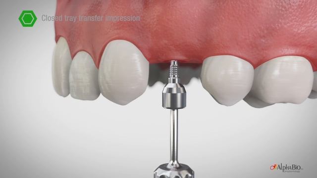 How to take open/ close tray impression? | Alpha-Bio Tec. смотреть онлайн