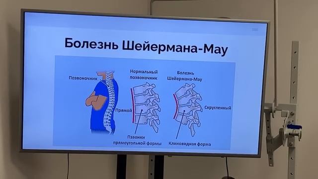 Упражнения от сутулости ? Разбор техники МФР и "сухое плавание" для осанки