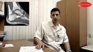 Почему болят пятки? У мужчины была выявлена пяточная шпора, но боль была по другой причине