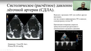 Лёгочная гипертензия. Лекция для практикующих ветеринарных врачей .