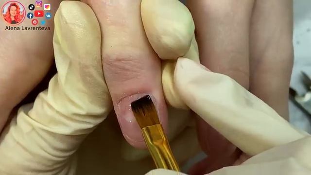 Расковыряла ногти / Почему ногти волнистые? смотреть онлайн