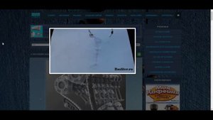 Белый дым из глушителя. Причины и неисправности