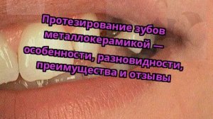 Протезирование зубов металлокерамикой — особенности, разновидности, преимущества и отзывы