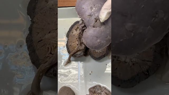 Почки. Соколова Е.А. смотреть онлайн