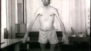 Миопатический синдром, миопатия © Myopathic syndrome, myopathy