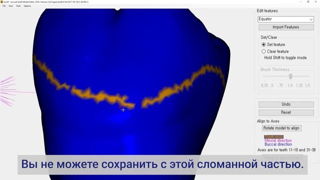 Как создать библиотеку зубов в экзокаде смотреть онлайн