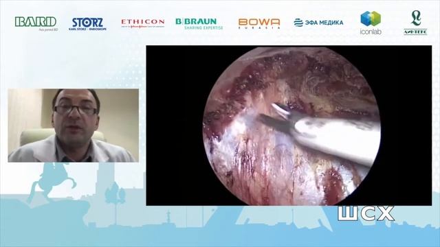 Н. Ермаков E-TEP-TAR при боковой грыже смотреть онлайн