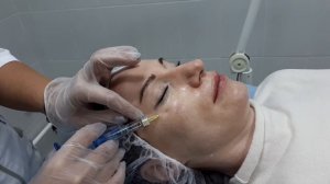 Биоревитализация, ответы на основные вопросы