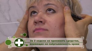 Фейслифтинг