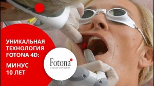 Лазерная подтяжка лица Fotona 4D_ лифтинг эффект, омоложение кожи