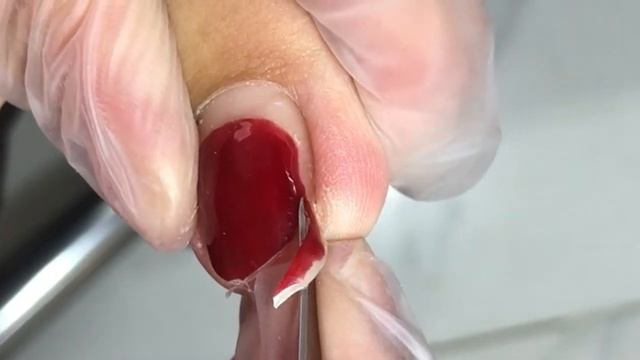 Beautiful toenail trim with ingrown nails!【Crazy pedicure room】 смотреть онлайн