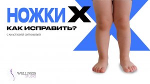 Как исправить X -образные ноги?.mp4