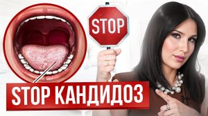 ВОТ, как НЕЛЬЗЯ лечить кандидоз – 4 ошибки. Как избавиться от кандиды?