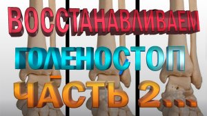 Упражнения для восстановления голеностопа после перелома. Часть 2... Плоскостопие...