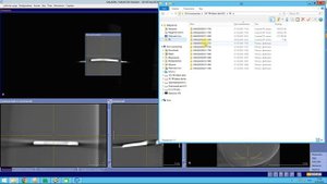 Как отправить снимок КТ