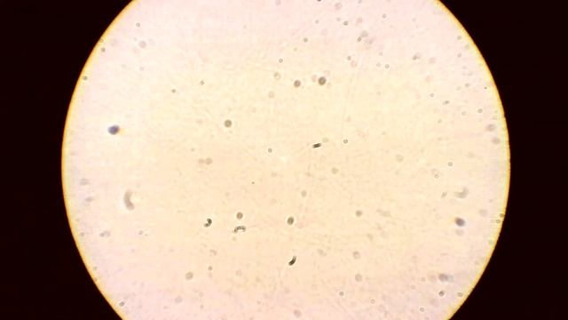 кровь под микроскопом смотреть онлайн