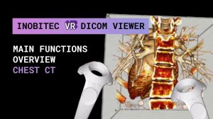 Обзор функциональности программы Inobitec VR DICOM Viewer. КТ грудной клетки.