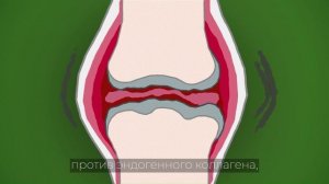 Хондрогард Трио Что бы суставы не болели