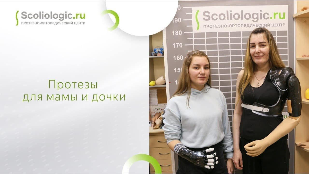 Бионические протезы за счет благотворительного фонда_ и такое возможно!