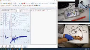 F-волна | Вебинар «ЭМГ для начинающих» Часть 4