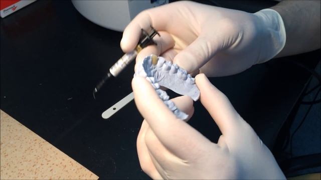 Изготовление ортодонтической капы смотреть онлайн