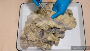 Брыжеечная часть тонкой кишки Толстая кишка