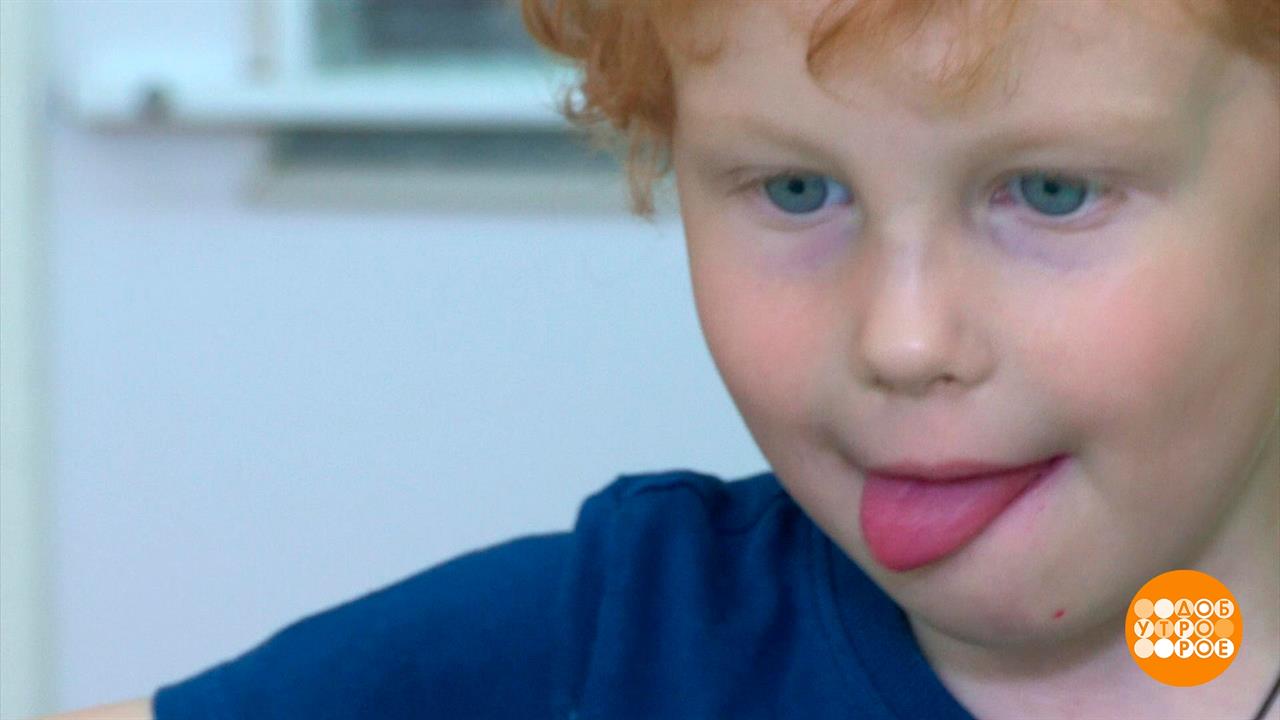 Рыжий, рыжий, конопатый... Доброе утро. Фрагмент выпуска от 06.09.2023