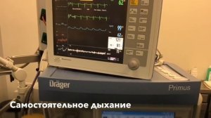 Торакоскопическая резекция легкого на спонтанном дыхании (РНЦХ)